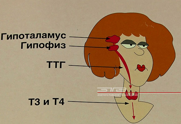 Предупреждён — значит вооружён. В Златоусте стартовала информационная акция в рамках «Всемирного дня щитовидной железы»